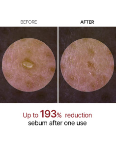 Dr. Melaxin Peel Shot Exfoliating White Rice Ampoule 80ml 2