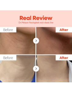 Dr. Melaxin Neck Sphaltecm Neck Barrier Cream 50ml 2