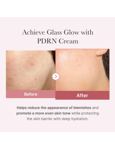 Medicube PDRN Pink Hyaluronic Moisturizing Cream 50ml 2