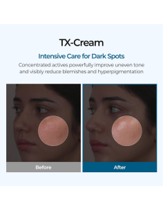 Dr. Melaxin Tx-Cream 50ml 2