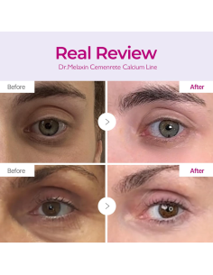 Dr. Melaxin Cemenrete Calcium Volume Cream 50ml 2