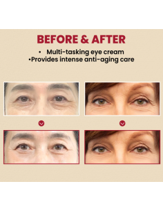 Ksecret Seoul 1988 Eye Cream Retinal Liposome 4- + Fermented Bean 2