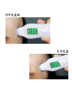 Двуфазен ампулен серум с Ниацинамид, Центела Азиатика и Аденозин Chamos Acaci 2